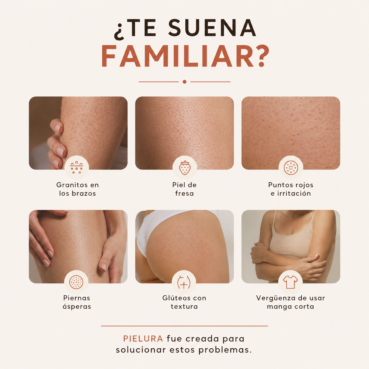 Tratamiento Para Queratosis Pilaris Avanzado