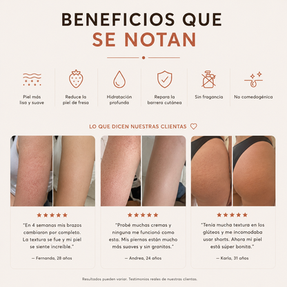 Tratamiento Para Queratosis Pilaris Avanzado